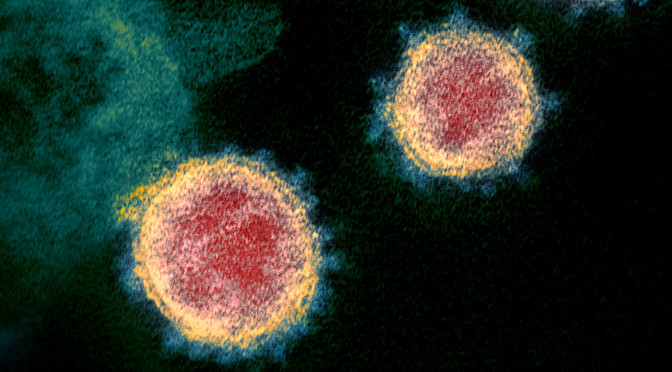 Coronaviruset COVID-19 - Risker vid MS