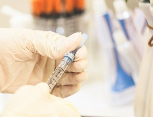 Svar om EBV-antikroppar, MS-kompensation, Ventrikel 4, Botox och Fillers